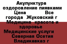 Акупунктура, оздоровление пиявками › Цена ­ 3 000 - Все города, Жуковский г. Медицина, красота и здоровье » Медицинские услуги   . Северная Осетия,Владикавказ г.